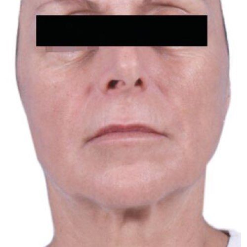 After image